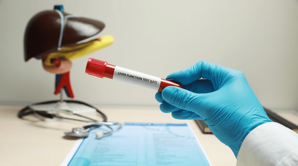 Що може показати тест на функції печінки